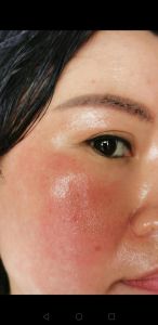 女人脸红的图片_尴尬害羞表情包，微信微博必备小神器！